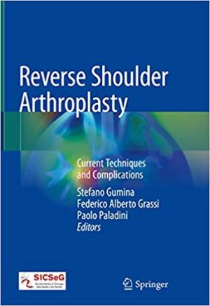 Reverse Shoulder Arthroplasty Current Techniques and Complications