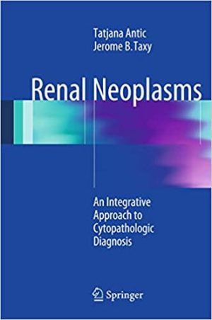 Renal Neoplasms An Integrative Approach To Cytopathologic Diagnosis