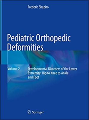 Pediatric Orthopedic Deformities Volume 2 Developmental Disorders of the Lower Extremity Hip to Knee to Ankle and Foot