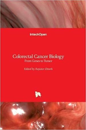 Colorectal Cancer Biology From Genes to Tumor
