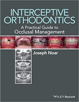 Interceptive Orthodontics A Practical Guide To Occlusal Management