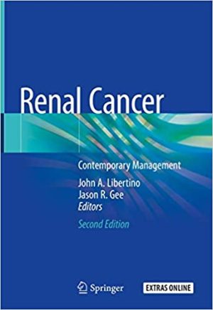 Renal Cancer Contemporary Management 2nd Edition