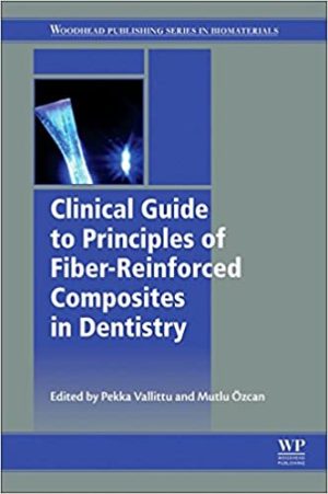 Clinical Guide to Principles of Fiber Reinforced Composites in Dentistry