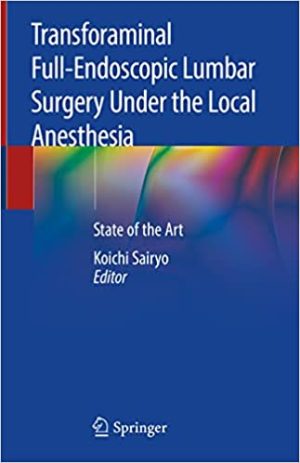 Transforaminal Full Endoscopic Lumbar Surgery Under the Local Anesthesia
