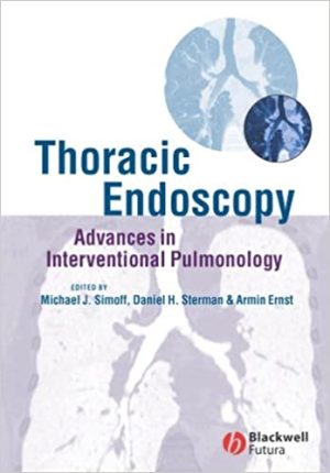 Thoracic Endoscopy Advances in Interventional Pulmonology
