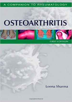 Osteoarthritis A Companion to Rheumatology