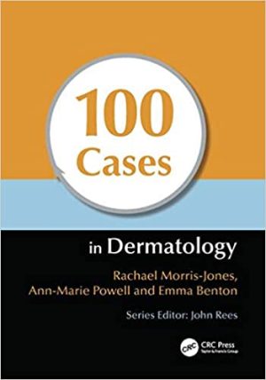 100 Cases In Dermatology