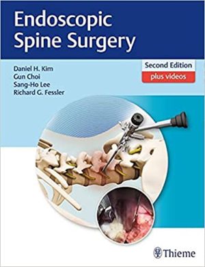 Endoscopic Spine Surgery 2nd Edition