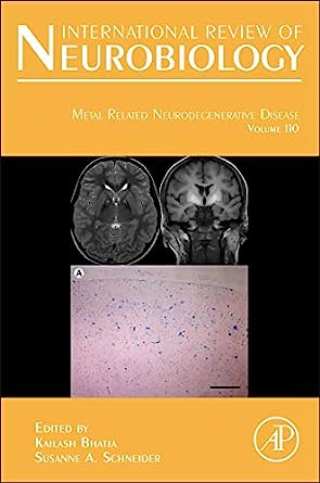 Metal Related Neurodegenerative Disease