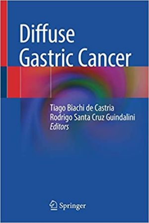Diffuse Gastric Cancer