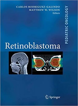 Retinoblastoma By Carlos Rodriguez Galindo