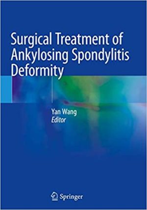Surgical Treatment of Ankylosing Spondylitis Deformity