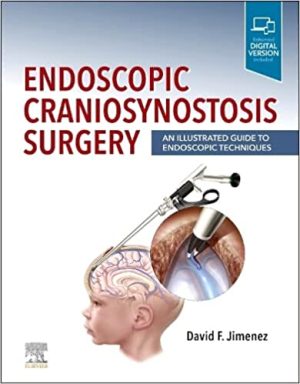 Endoscopic Craniosynostosis Surgery An Illustrated Guide to Endoscopic Techniques