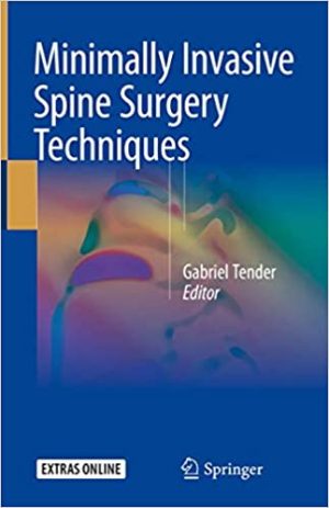 Minimally Invasive Spine Surgery Techniques