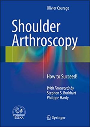 Shoulder Arthroscopy How to Succeed