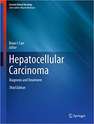 Hepatocellular Carcinoma Diagnosis and Treatment 3rd Edition