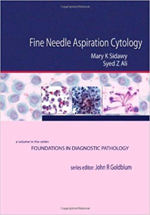 Fine Needle Aspiration Cytology A Volume in Foundations in Diagnostic Pathology