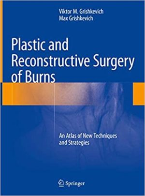 Plastic and Reconstructive Surgery of Burns An Atlas of New Techniques and Strategies