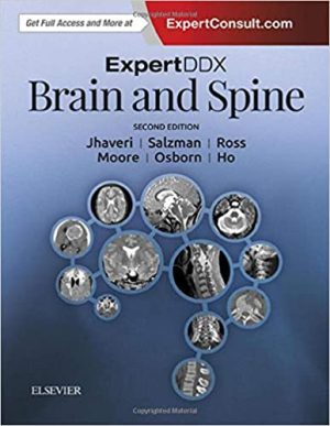 ExpertDDx Brain and Spine 2nd Edition