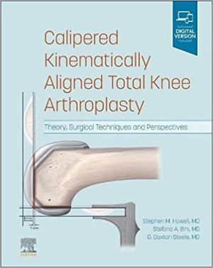 Calipered Kinematically aligned Total Knee Arthroplasty Theory Surgical Techniques and Perspectives