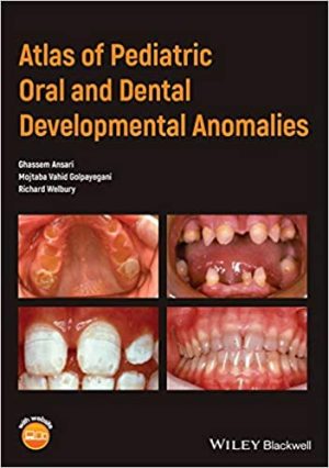 Atlas of Pediatric Oral And Dental Developmental Anomalies