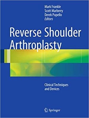 Reverse Shoulder Arthroplasty Biomechanics Clinical Techniques and Current Technologies