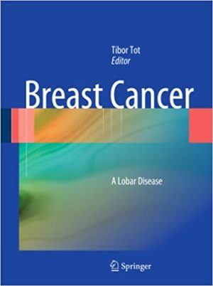 Breast Cancer A Lobar Disease