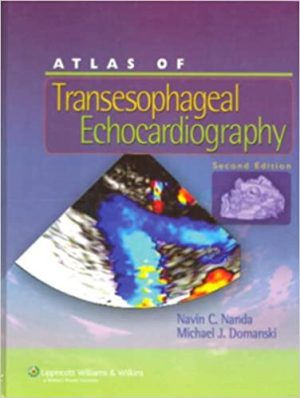 Atlas of Transesophageal Echocardiography 2nd Edition