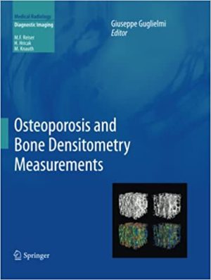 Osteoporosis and Bone Densitometry Measurements