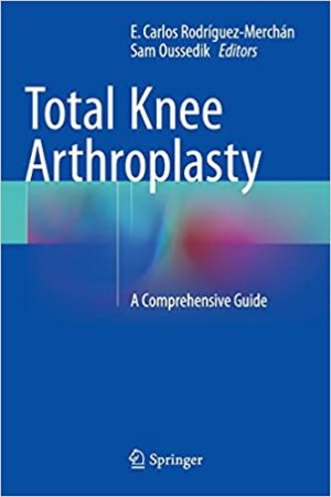 Total Knee Arthroplasty A Comprehensive Guide