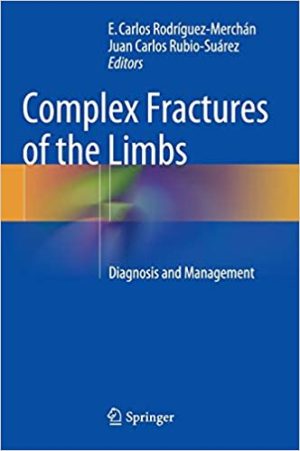 Complex Fractures of the Limbs Diagnosis and Management