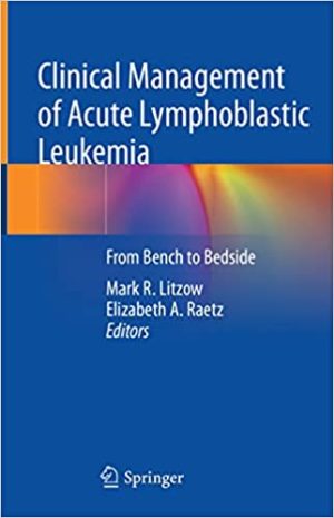 Clinical Management of Acute Lymphoblastic Leukemia From Bench to Bedside