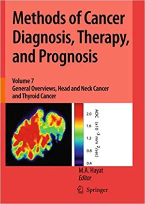 Methods of Cancer Diagnosis Therapy and Prognosis Volume 7 General Overviews Head and Neck Cancer and Thyroid Cancer