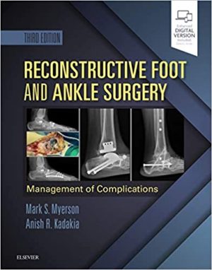 Reconstructive Foot and Ankle Surgery Management of Complications 3rd Ed