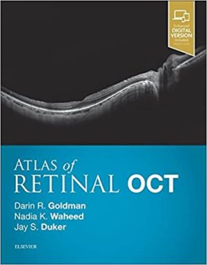 Atlas of Retinal OCT Optical Coherence Tomography