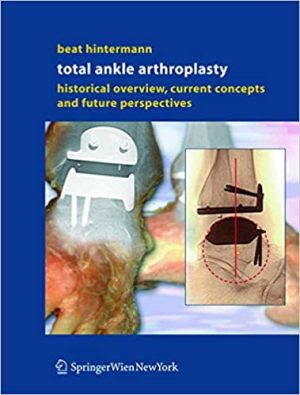 Total Ankle Arthroplasty Historical Overview Current Concepts and Future Perspectives