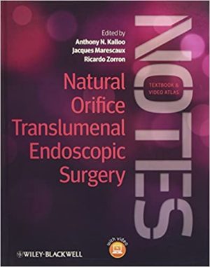 Natural Orifice Translumenal Endoscopic Surgery