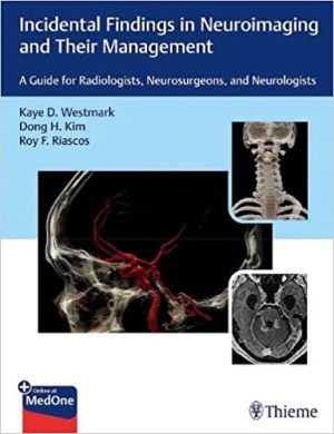 Incidental Findings in Neuroimaging and Their Management A Guide for Radiologists Neurosurgeons and Neurologists