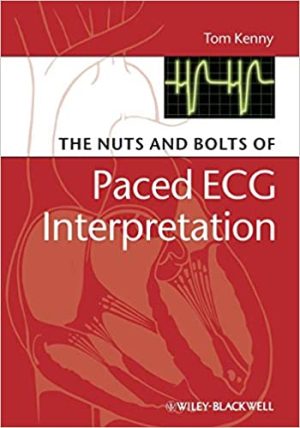 The Nuts and bolts of Paced ECG Interpretation