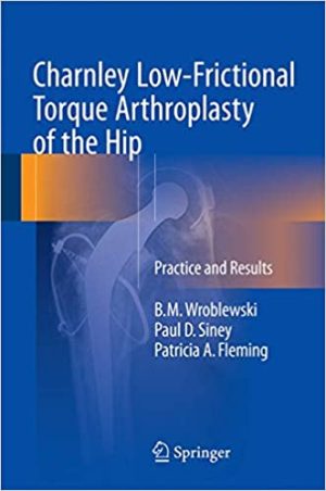 Charnley Low Frictional Torque Arthroplasty of the Hip Practice and Results