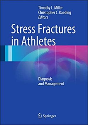 Stress Fractures in Athletes Diagnosis and Management