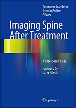 Imaging Spine After Treatment A Case Based Atlas