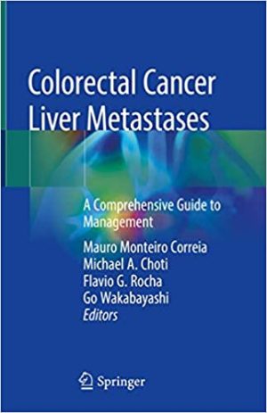 Colorectal Cancer Liver Metastases A Comprehensive Guide to Management