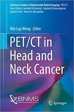 PET CT in Head and Neck Cancer