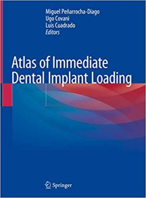 Atlas of Immediate Dental Implant Loading