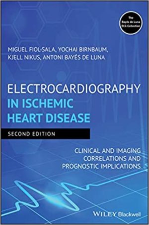 Electrocardiography in Ischemic Heart Disease Clinical and Imaging Correlations and Prognostic Implications 2nd Edition