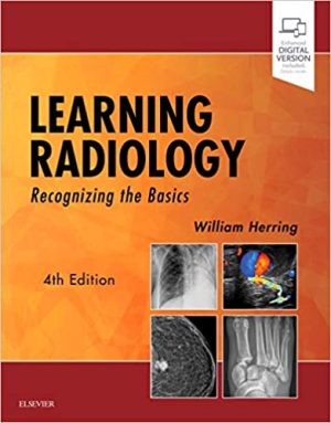 Learning Radiology Recognizing the Basics 4th Edition