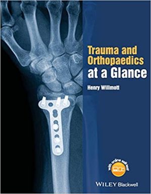 Trauma and Orthopaedics at a Glance