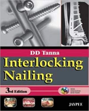 Interlocking Nailing 3rd Edition