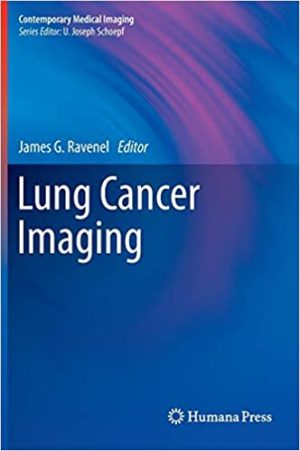 Lung Cancer Imaging